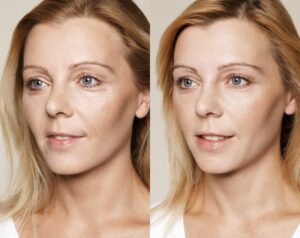 скинбустери