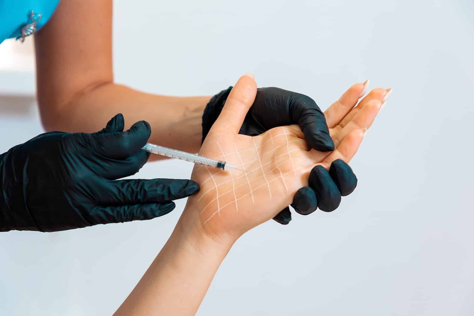 хиперхидроза (прекомерно изпотяване)